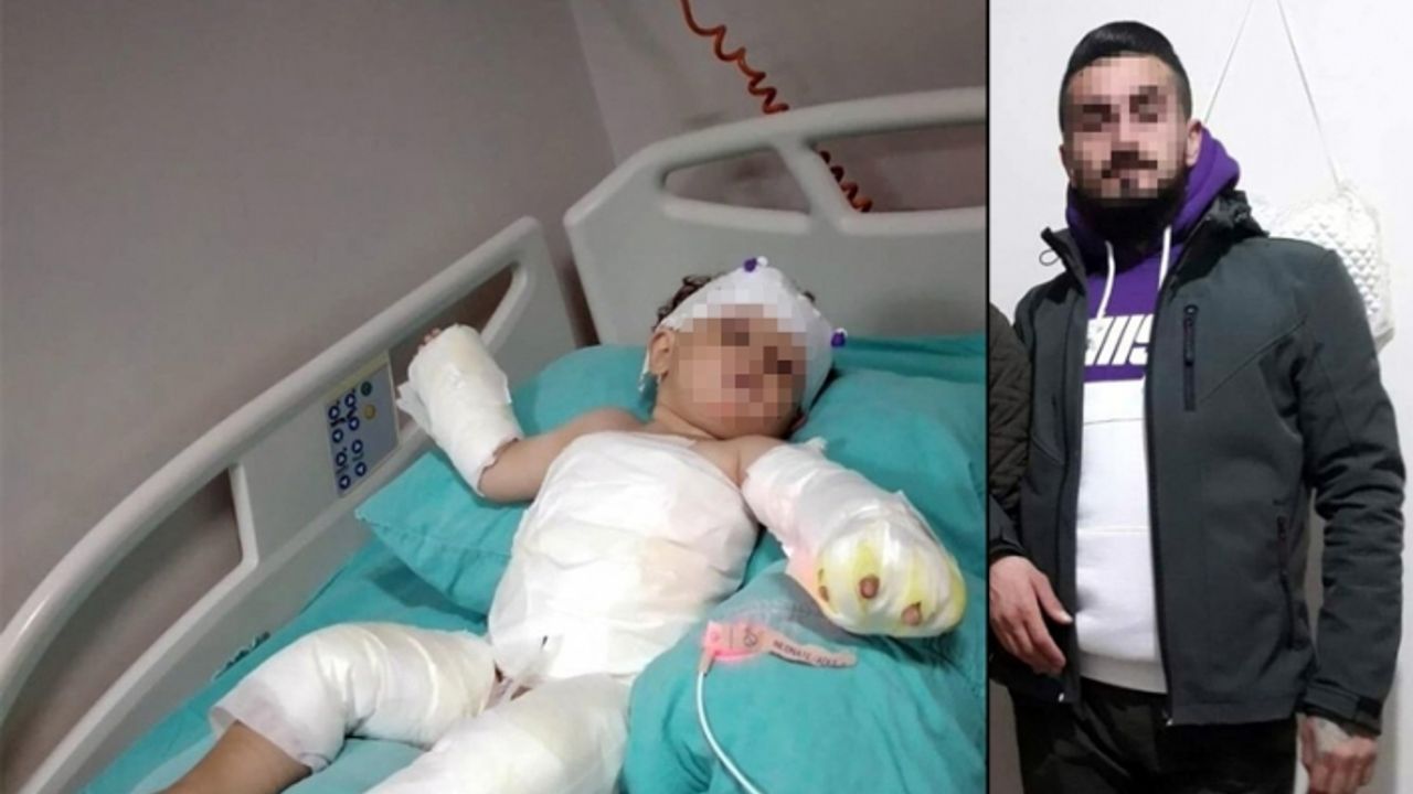 İzmir'de kan donduran olay! Eşi ve 1,5 yaşındaki oğlunu kolonya ile yaktı!